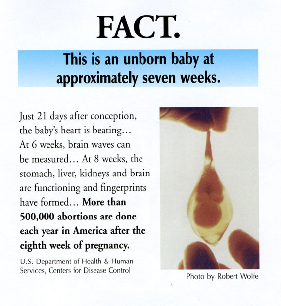 10_Int_350_abortion_facts-3